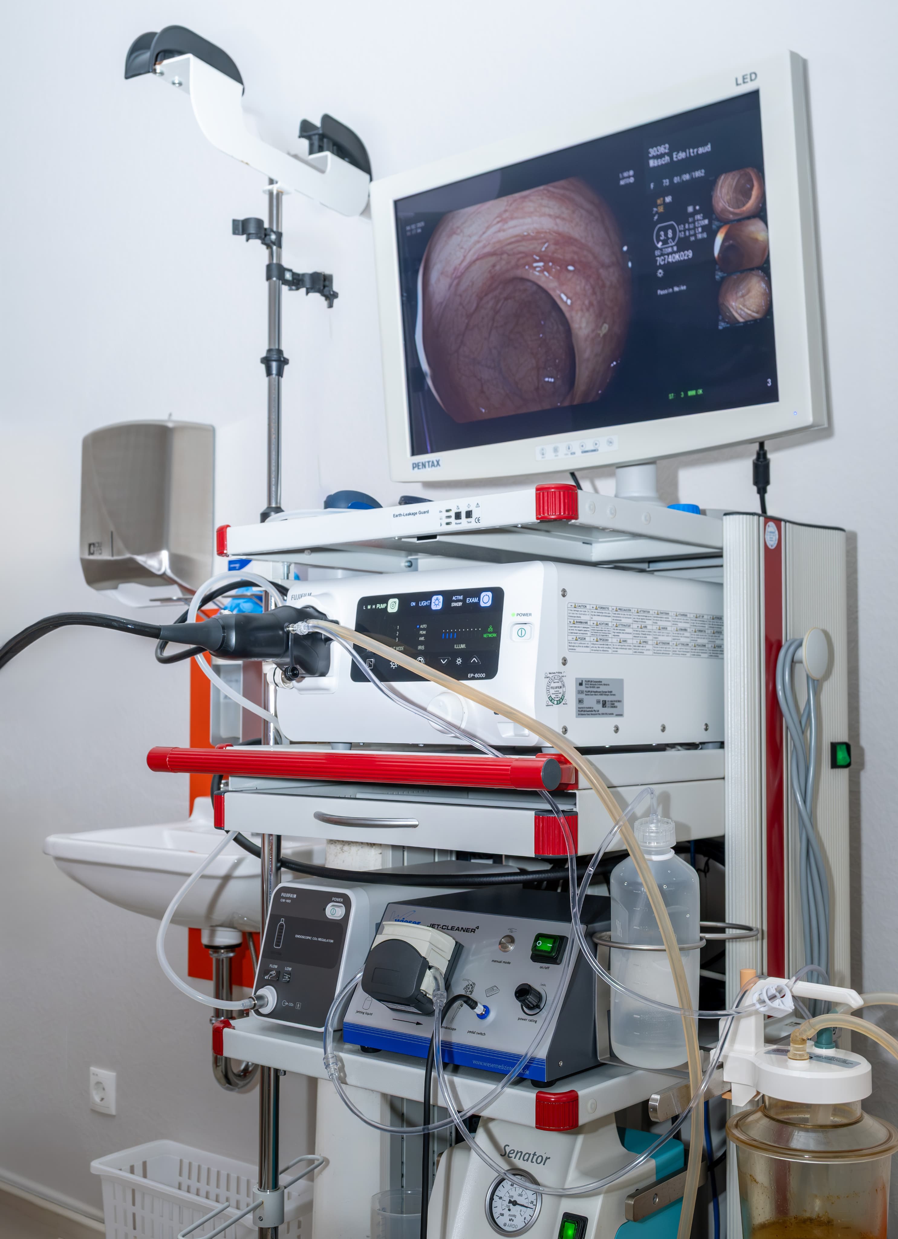 Gastroskopie (Magenspiegelung)